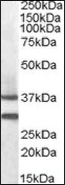 Anti-MC5R antibody produced in goat affinity isolated antibody, buffered aqueous solution