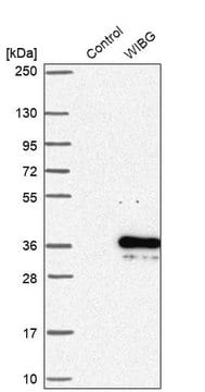 Anti-PYM1 antibody produced in rabbit Prestige Antibodies&#174; Powered by Atlas Antibodies, affinity isolated antibody, buffered aqueous glycerol solution