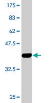 Monoclonal Anti-KRT13 antibody produced in mouse clone 4F5, purified immunoglobulin, buffered aqueous solution