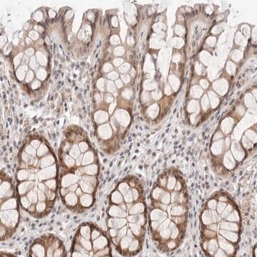 Anti-ITGB3BP antibody produced in rabbit Prestige Antibodies&#174; Powered by Atlas Antibodies, affinity isolated antibody, buffered aqueous glycerol solution