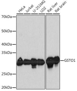 Anti-GSTO1 Antibody, clone 7L9P3, Rabbit Monoclonal