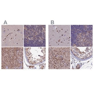 Anti-DNPEP antibody produced in rabbit Prestige Antibodies&#174; Powered by Atlas Antibodies, affinity isolated antibody, buffered aqueous glycerol solution