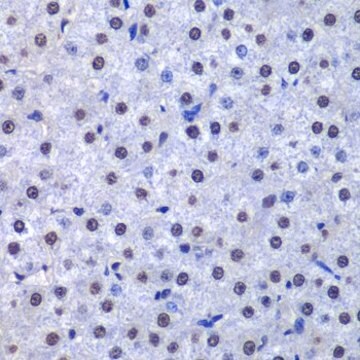 Anti-GSTP1 antibody produced in rabbit