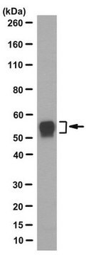 Anti-IFIT5 Antibody, clone 10A12.1 clone 10A12.1, from mouse