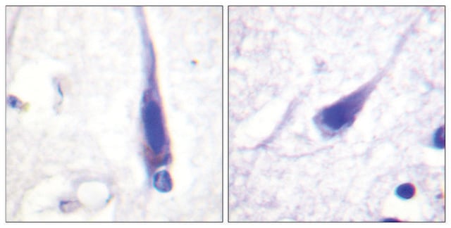 Anti-Calmodulin antibody produced in rabbit affinity isolated antibody