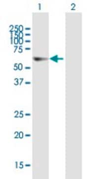 Anti-ELP3 antibody produced in mouse purified immunoglobulin, buffered aqueous solution