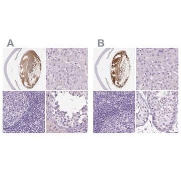 Anti-LGSN antibody produced in rabbit Prestige Antibodies&#174; Powered by Atlas Antibodies, affinity isolated antibody, buffered aqueous glycerol solution