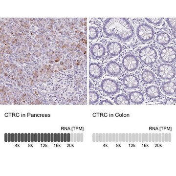 Anti-CTRC antibody produced in rabbit Prestige Antibodies&#174; Powered by Atlas Antibodies, affinity isolated antibody, buffered aqueous glycerol solution