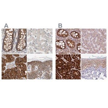 Anti-GPD2 antibody produced in rabbit Prestige Antibodies&#174; Powered by Atlas Antibodies, affinity isolated antibody, buffered aqueous glycerol solution