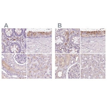 Anti-HEXB antibody produced in rabbit Prestige Antibodies&#174; Powered by Atlas Antibodies, affinity isolated antibody, buffered aqueous glycerol solution