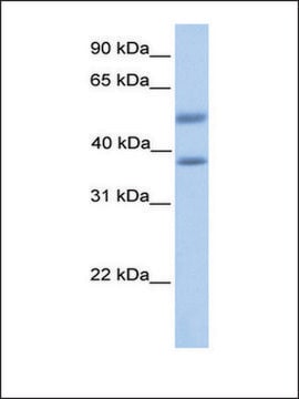 Anti-ST6GALNAC2 antibody produced in rabbit affinity isolated antibody