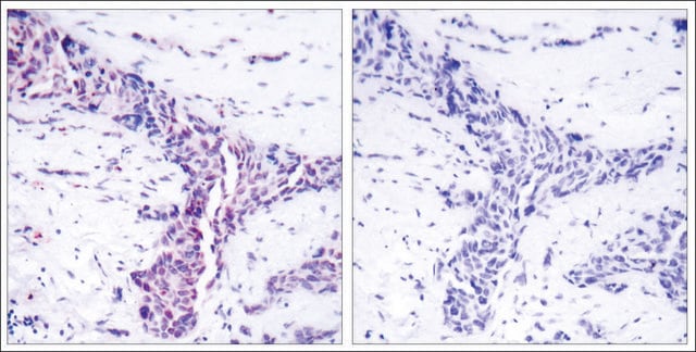 Anti-ATF2 (Ab-73 or 55) antibody produced in rabbit affinity isolated antibody