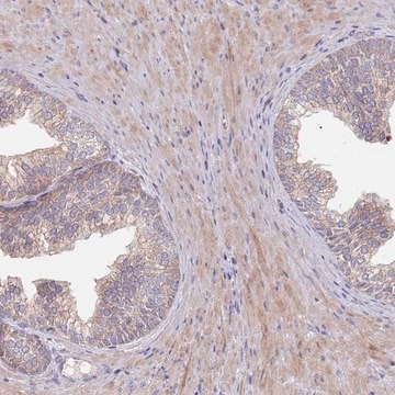 Anti-ABCC10 antibody produced in rabbit Prestige Antibodies&#174; Powered by Atlas Antibodies, affinity isolated antibody, buffered aqueous glycerol solution