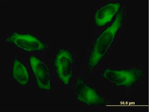 Anti-AARS antibody produced in mouse purified immunoglobulin, buffered aqueous solution