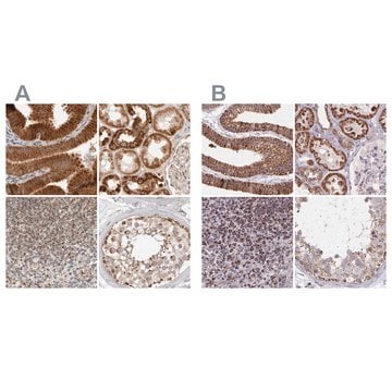 Anti-DYRK4 antibody produced in rabbit Prestige Antibodies&#174; Powered by Atlas Antibodies, affinity isolated antibody, buffered aqueous glycerol solution