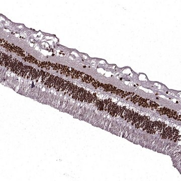 Anti-RB1 antibody produced in rabbit Prestige Antibodies&#174; Powered by Atlas Antibodies, affinity isolated antibody, buffered aqueous glycerol solution