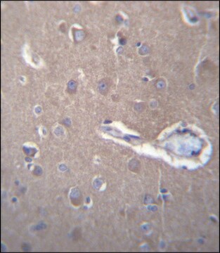 ANTI-SEC62 (N-TERM) antibody produced in rabbit IgG fraction of antiserum, buffered aqueous solution