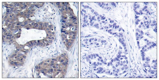 Anti-IRS-1 antibody produced in rabbit affinity isolated antibody