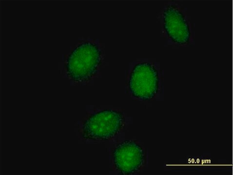 Anti-SSBP2 antibody produced in mouse purified immunoglobulin, buffered aqueous solution