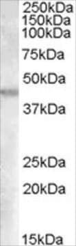 Anti-GOT2 (AA 295-306) antibody produced in goat affinity isolated antibody, buffered aqueous solution