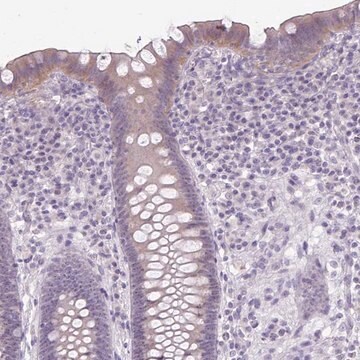 Anti-NHSL2 antibody produced in rabbit Prestige Antibodies&#174; Powered by Atlas Antibodies, affinity isolated antibody, buffered aqueous glycerol solution