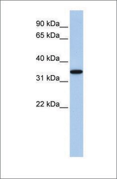 Anti-ART4 antibody produced in rabbit affinity isolated antibody