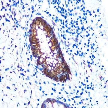 Anti-Galectin 3/LGALS3 antibody produced in rabbit