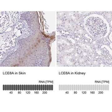 Anti-LCE6A antibody produced in rabbit Prestige Antibodies&#174; Powered by Atlas Antibodies, affinity isolated antibody, buffered aqueous glycerol solution