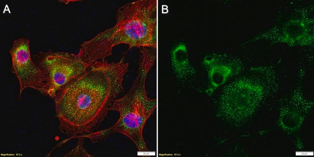 Anti-FLT4 Antibody, clone 2F4 ZooMAb&#174; Rabbit Monoclonal recombinant, expressed in HEK 293 cells