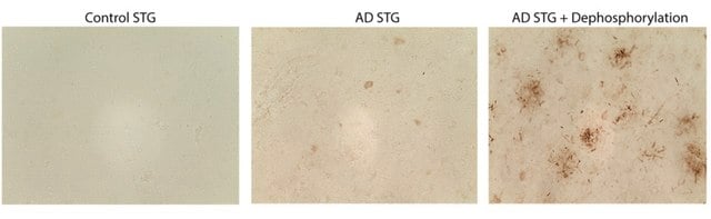 Anti-Tau Antibody, clone 10C5