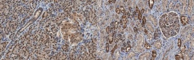 Anti-E3 ubiquitin-protein ligase UBR1 Antibody, clone 6H9.1 clone 6H9.1, from mouse