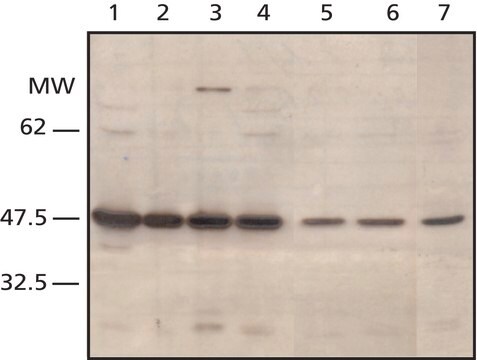 Anti-FEN-1 (C-terminal) antibody produced in rabbit ~1&#160;mg/mL, affinity isolated antibody, buffered aqueous solution