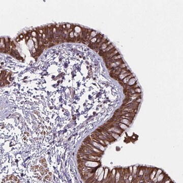 Anti-TANK antibody produced in rabbit Prestige Antibodies&#174; Powered by Atlas Antibodies, affinity isolated antibody, buffered aqueous glycerol solution