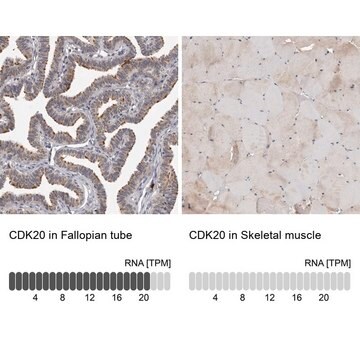 Anti-CDK20 antibody produced in rabbit Prestige Antibodies&#174; Powered by Atlas Antibodies, affinity isolated antibody, buffered aqueous glycerol solution, ab1