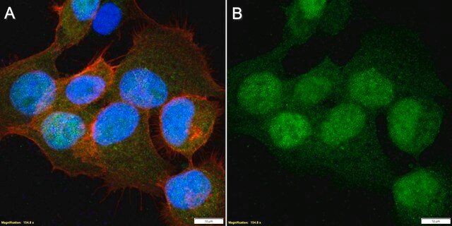 Anti-SOX4 Antibody, clone 2K15 ZooMAb&#174; Rabbit Monoclonal recombinant, expressed in HEK 293 cells