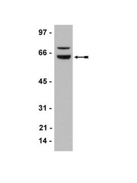 Anti-WT1-Antikörper, Klon 6F-H2 clone 6F-H2, Upstate&#174;, from mouse