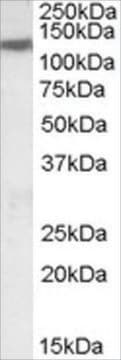 Anti-KCC3/SLC12A6 antibody produced in goat affinity isolated antibody, buffered aqueous solution