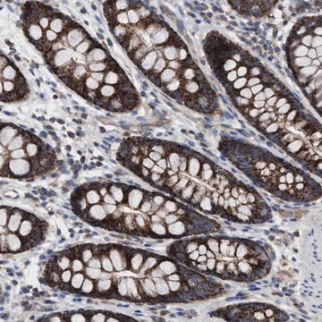 Anti-MRM1 antibody produced in rabbit Prestige Antibodies&#174; Powered by Atlas Antibodies, affinity isolated antibody, buffered aqueous glycerol solution