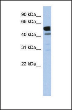 Anti-LDHD antibody produced in rabbit affinity isolated antibody