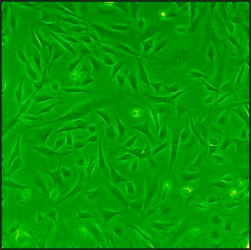 Rat Cardiac Fibroblasts: RCF, adult