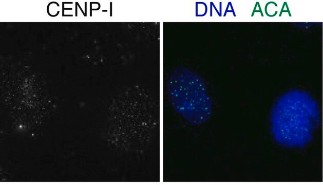 Anti-CENPI antibody produced in rabbit affinity isolated antibody