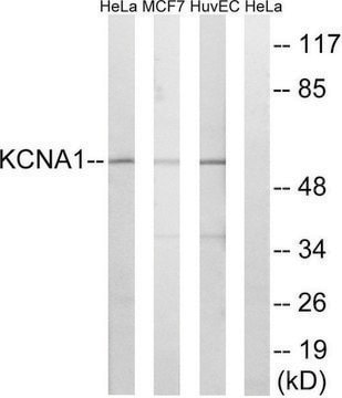 Anti-KCNA1 antibody produced in rabbit affinity isolated antibody