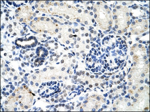 Anti-DDX17 antibody produced in rabbit IgG fraction of antiserum