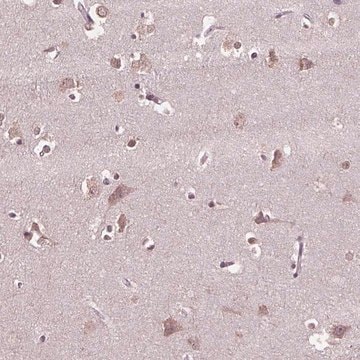 Anti-CPT1C antibody produced in rabbit Prestige Antibodies&#174; Powered by Atlas Antibodies, affinity isolated antibody