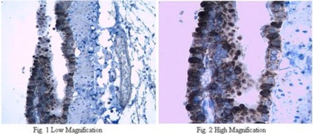 Anticuerpo anti-proteína surfactante B from rabbit, purified by affinity chromatography