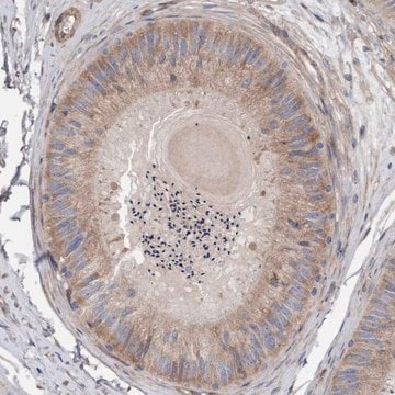 Anti-CDK5RAP3 antibody produced in rabbit Prestige Antibodies&#174; Powered by Atlas Antibodies, affinity isolated antibody, buffered aqueous glycerol solution, Ab2