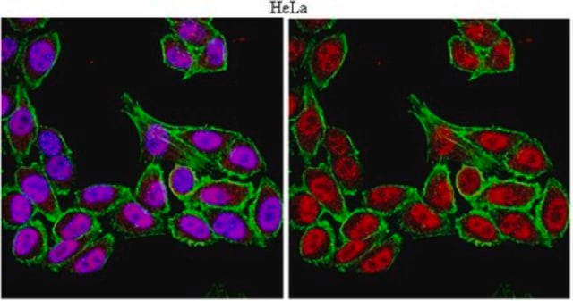 Anti-FoxP4 Antibody serum, from rabbit