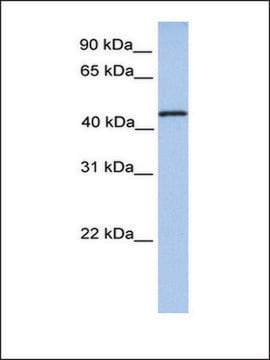 Anti-TRMT11 antibody produced in rabbit affinity isolated antibody