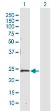 Anti-CBR4 antibody produced in rabbit purified immunoglobulin, buffered aqueous solution