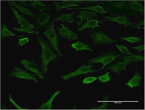 Monoclonal Anti-SGK2 antibody produced in mouse clone 2F6, purified immunoglobulin, buffered aqueous solution